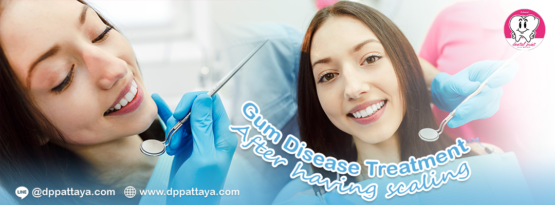 Gum Disease Treatment After having scaling