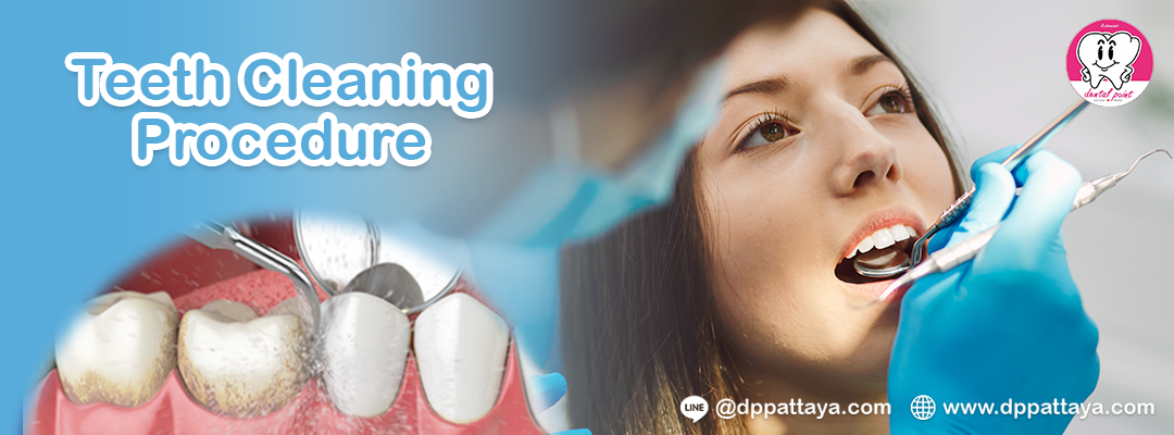 Teeth Cleaning Scaling and Polishing Procedure