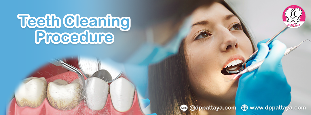 Teeth Cleaning Scaling and Polishing Procedure Teeth Cleaning Scaling and Polishing Procedure