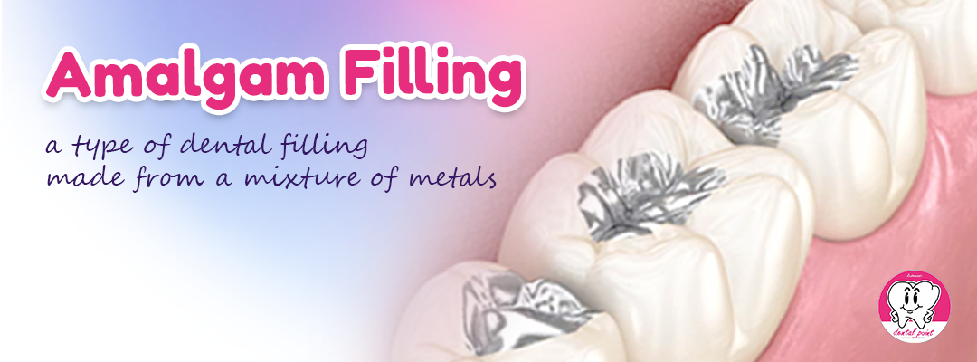amalgam tooth filling amalgam tooth filling