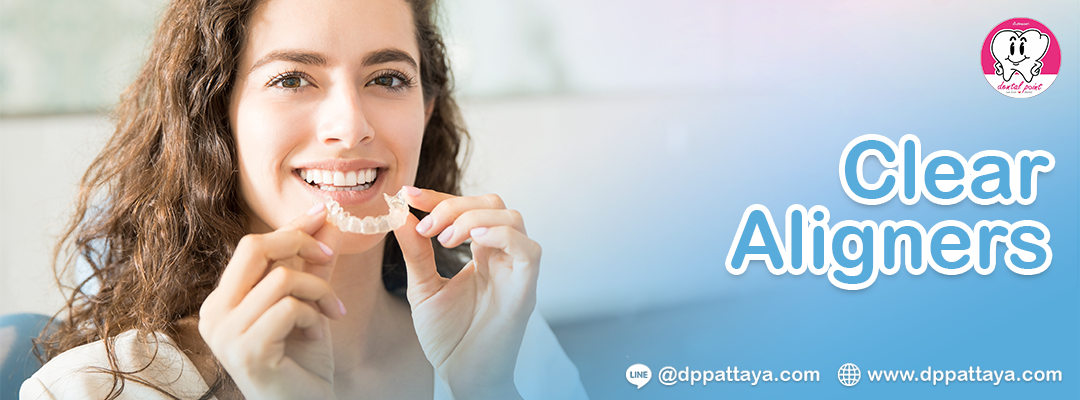 Clear Aligners Clear Aligners