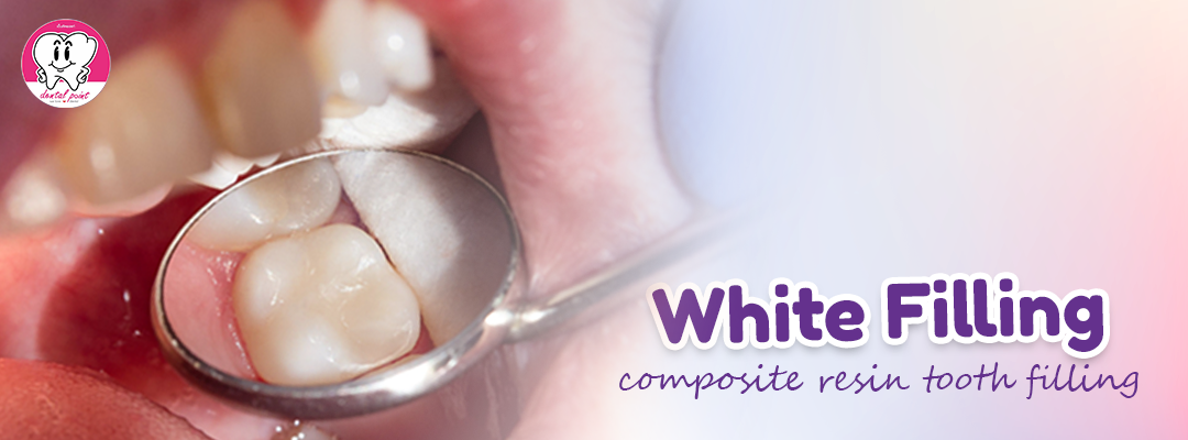 composite resin tooth filling composite resin tooth filling
