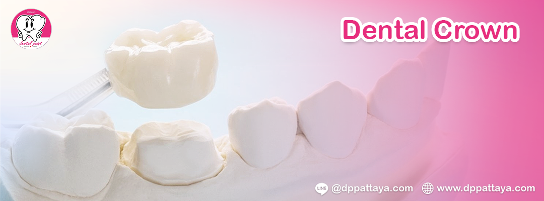 Dental Crown Dental Crown