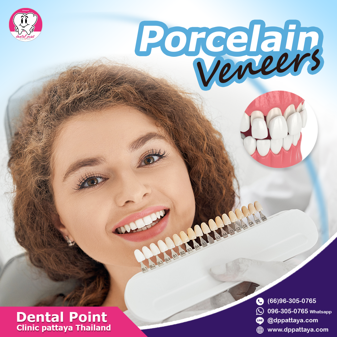 porcelain veneers porcelain veneers