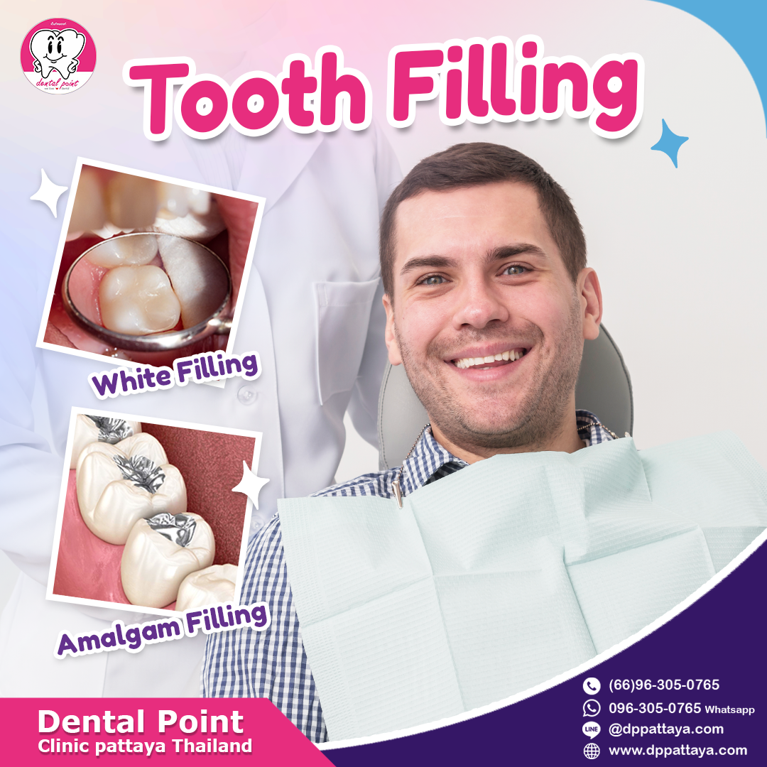 tooth filling tooth filling