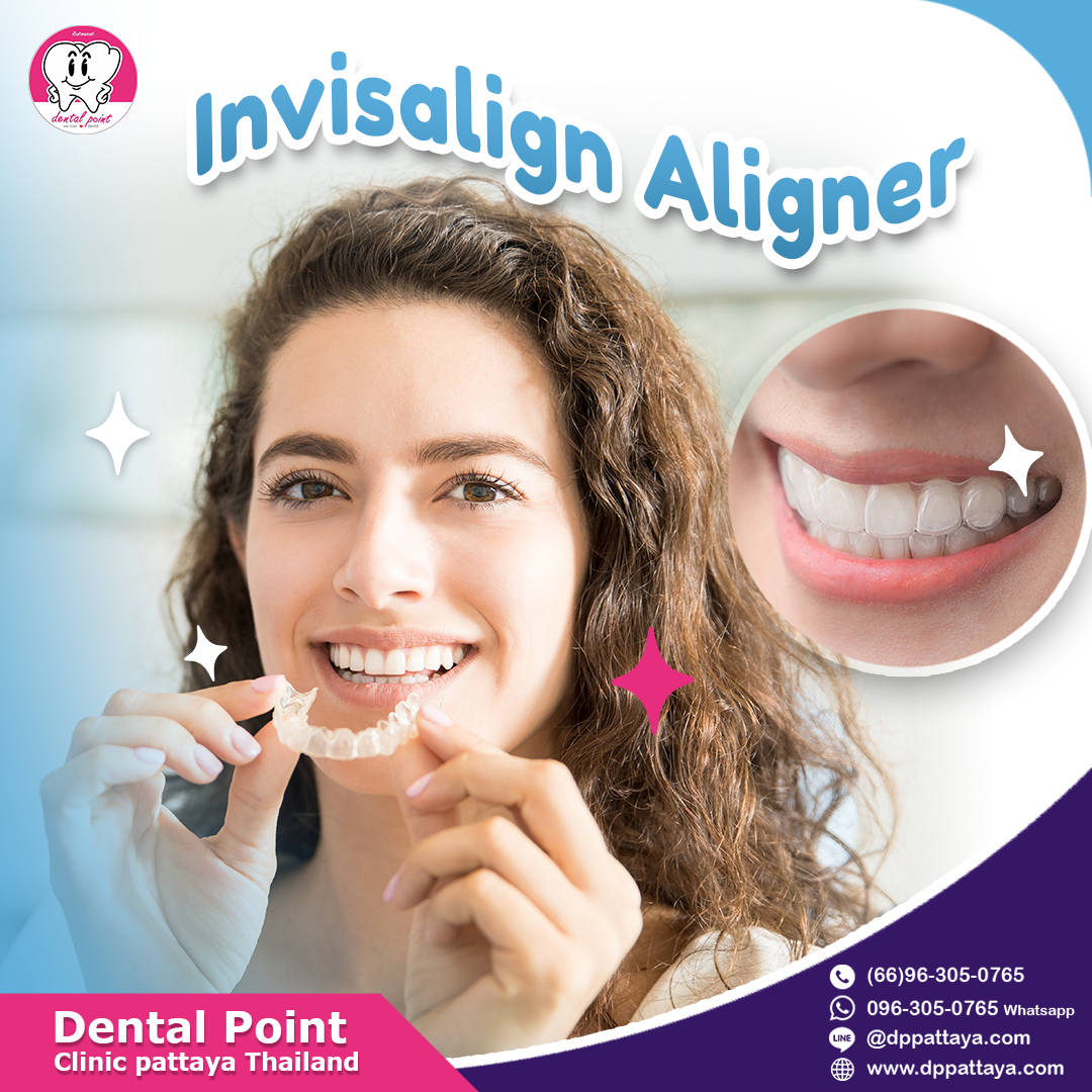 Invisalign Aligner Invisalign Aligner
