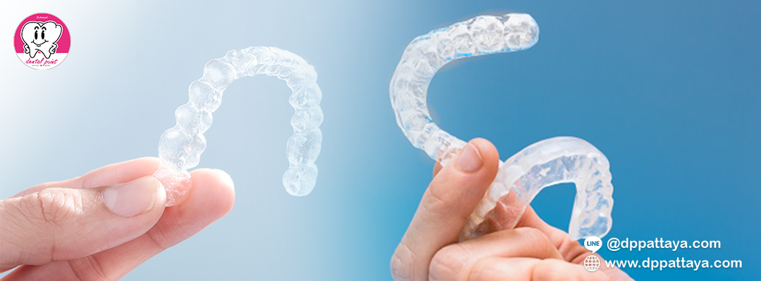 Clear Retainers, Night Guards or Mouth Guards