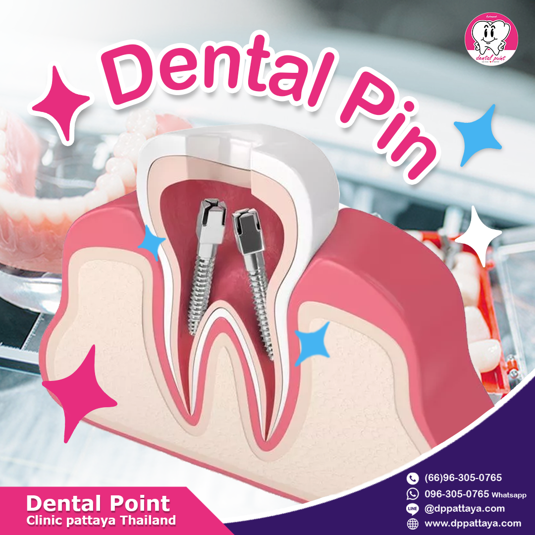 Dental Pin Dental Pin