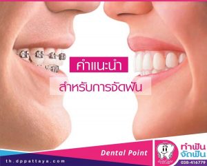 จัดฟัน คำแนะนำในการจัดฟัน