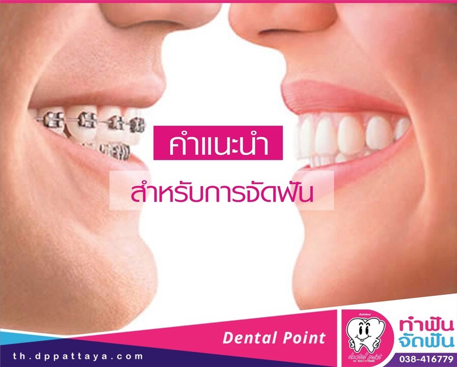 คำแนะนำสำหรับการจัดฟัน