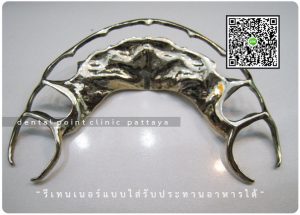 รีเทนเนอร์แบบใส่รับประทานอาหารได้ (All Metal Retainer)