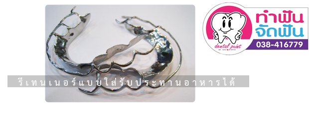 รีเทนเนอร์แบบใส่รับประทานอาหารได้ (All Metal Retainer)