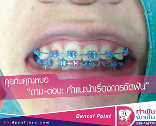 คุยกับคุณหมอ “ถาม-ตอบ: คำแนะนำเรื่องการจัดฟัน”