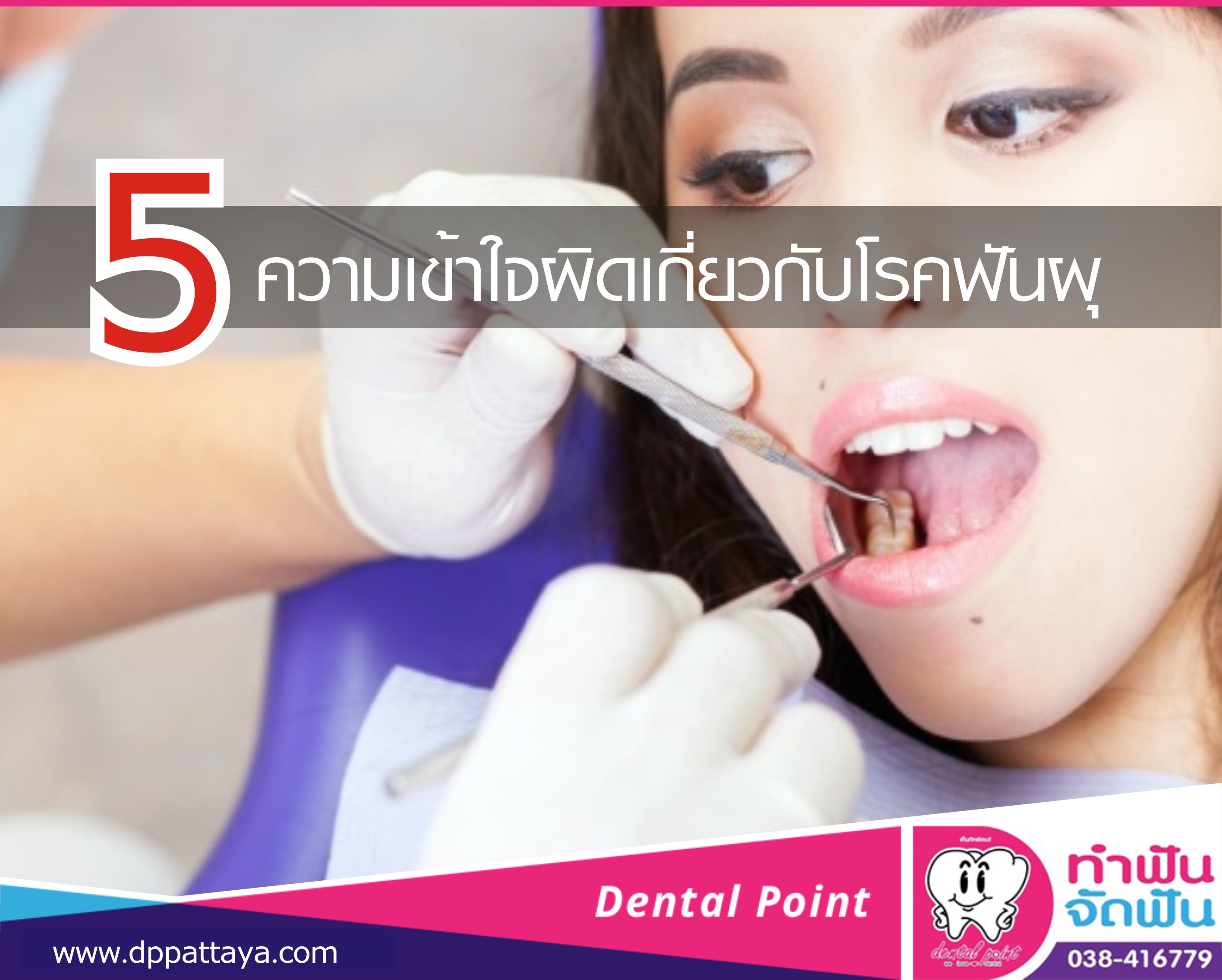 5 ความเข้าใจผิดเกี่ยวกับโรคฟันผุ