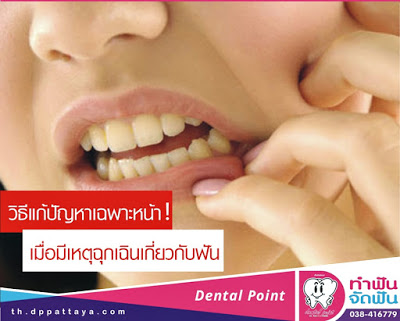 วิธีรับมือกับสถานการณ์ฉุกเฉิน ปวดฟัน ฟันหลุด ฟันแตก ฟันร้าว มีอะไรก็ไม่รู้ติดอยู่ในซอกฟัน 