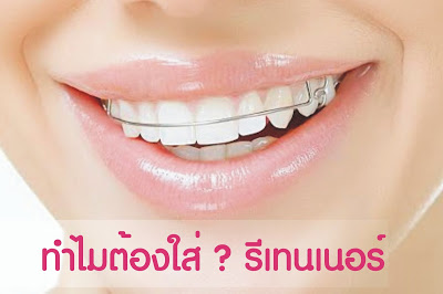 รีเทนเนอร์จำเป็นต่อการจัดฟันแค่ไหน ทำไมถึงต้องใส่?