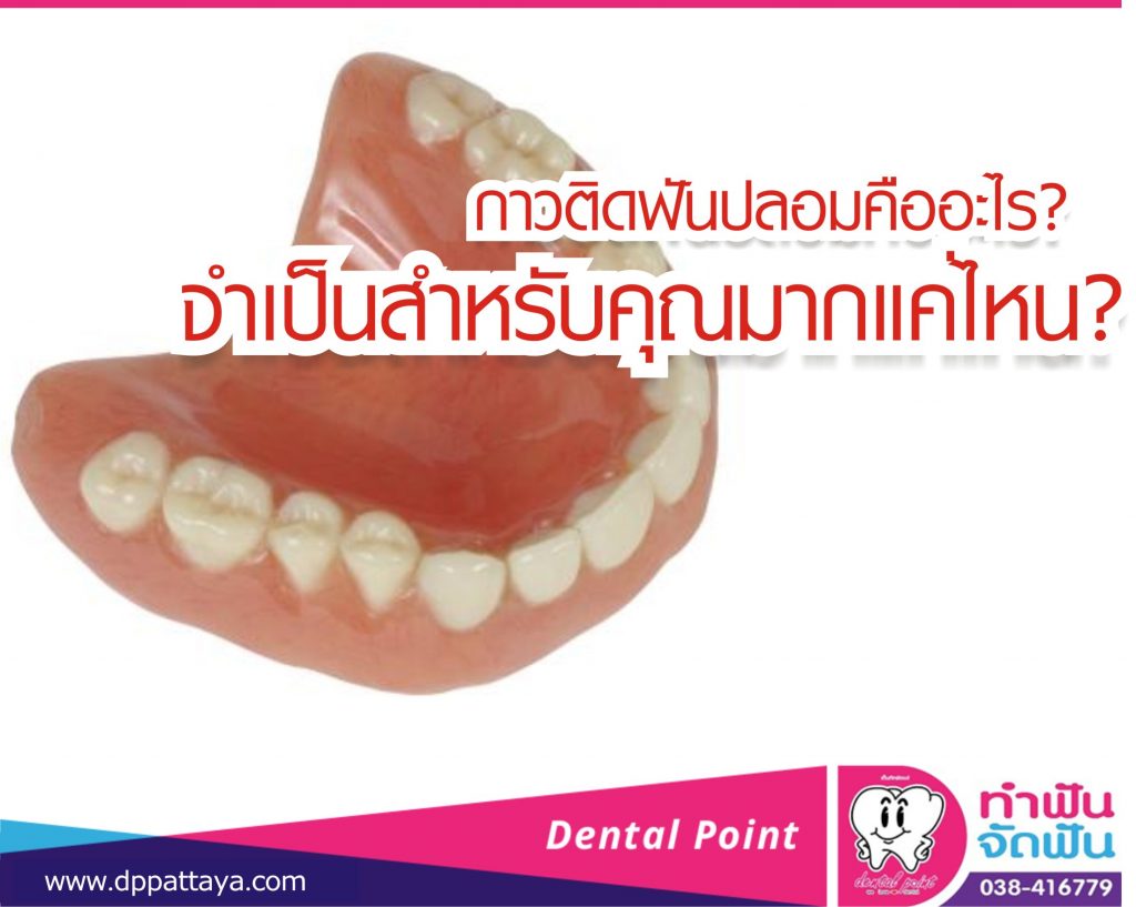 กาวติดฟันปลอม คืออะไร จำเป็นแค่ไหน