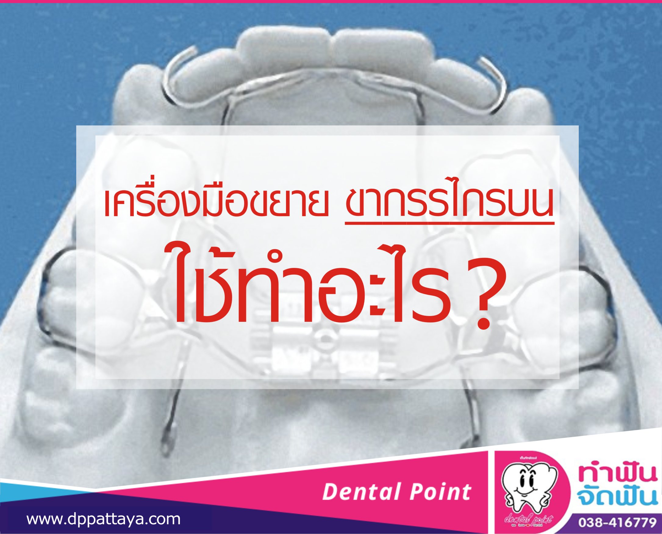 เครื่องมือขยายขากรรไกรบนใช้ทำอะไร?