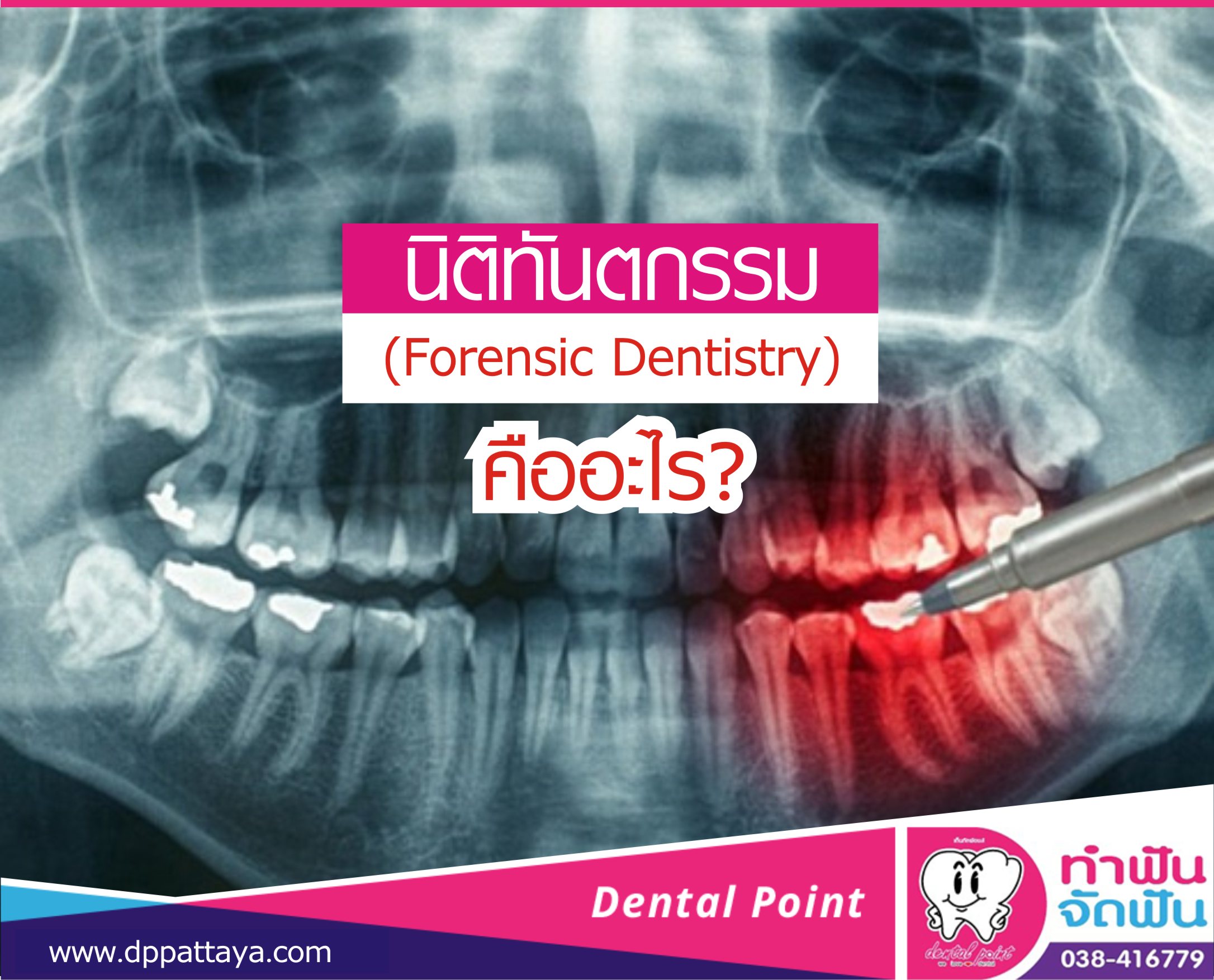 นิติทันตกรรม(Forensic Dentistry) คืออะไร?