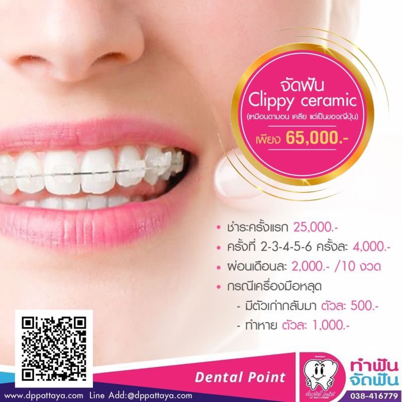 จัดฟันคลิปปี้ 65,000