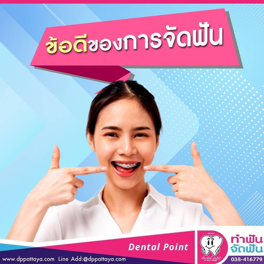 ข้อดีของการจัดฟัน