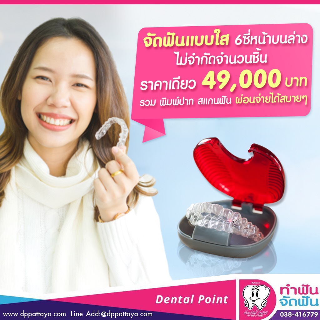 จัดฟันแบบใส ราคาเดียว 49000