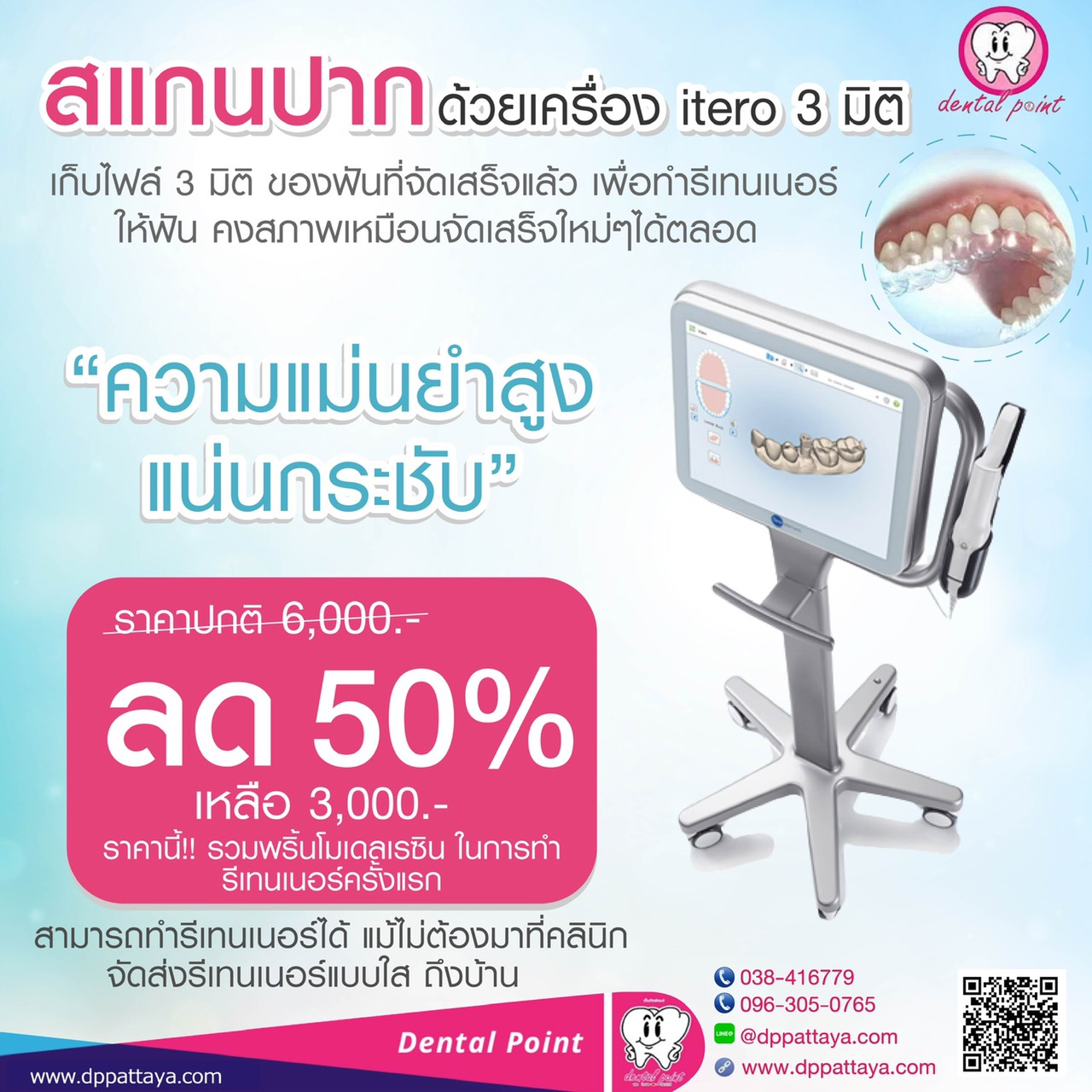 สแกนปาก itero 3มิติ ลด 50%