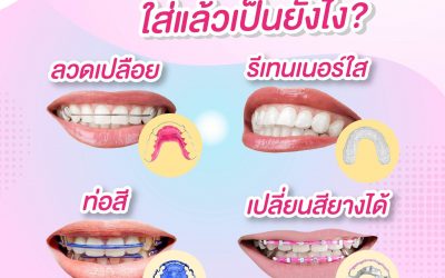 รีเทนเนอร์