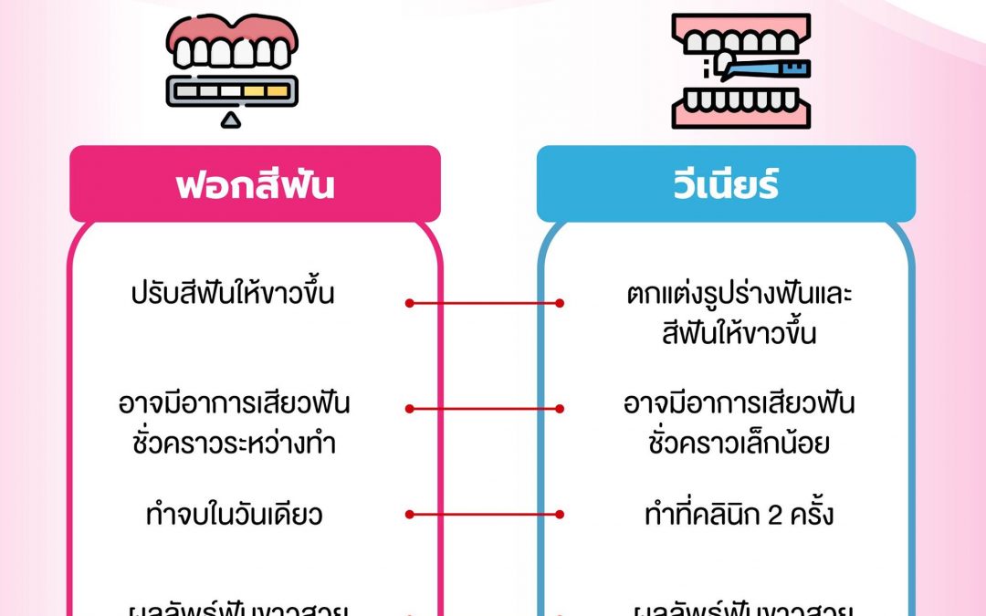 อยากฟันขาวสวย เลือกวิธีไหนดี วีเนียร์ VS ฟอกสีฟัน