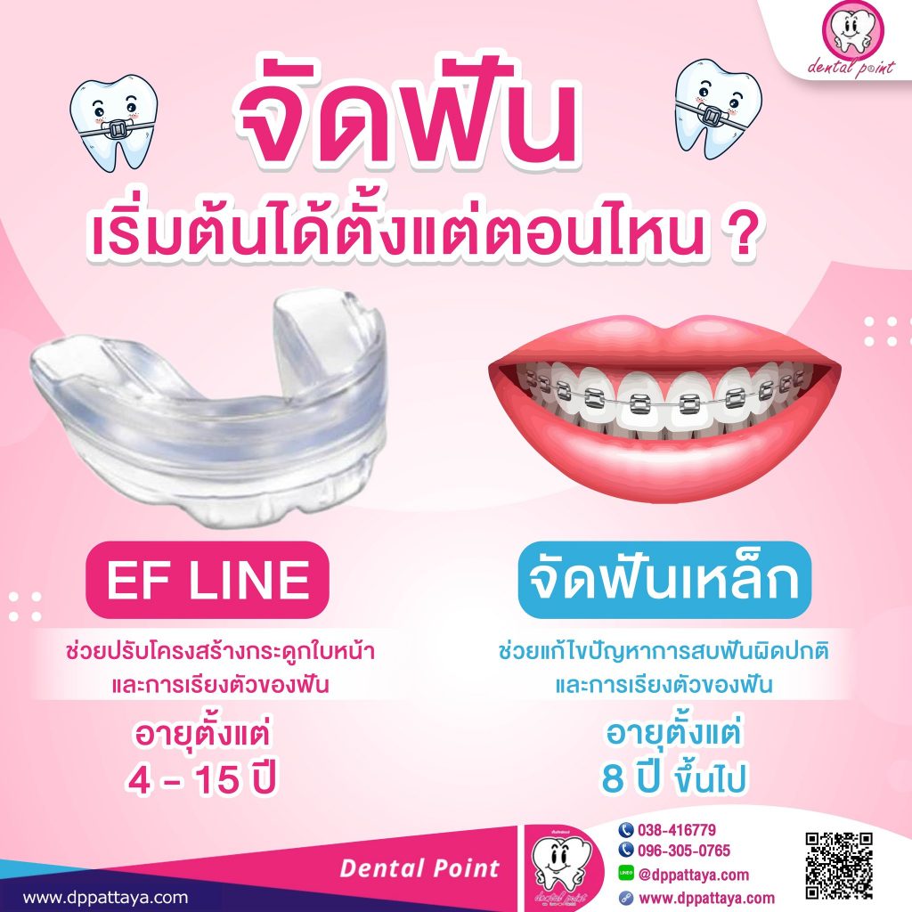 จัดฟันเด็ก Ef line