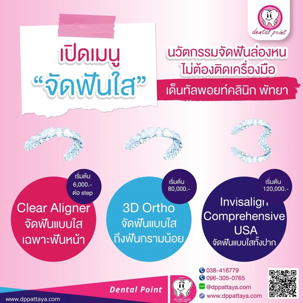 ราคาจัดฟันใส Invisalign