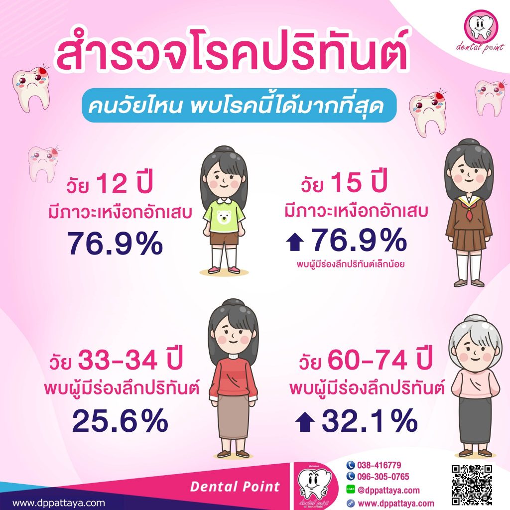 ผลสำรวจโรคปริทันต์ คนวัยไหน พบโรคนี้ได้มากที่สุด