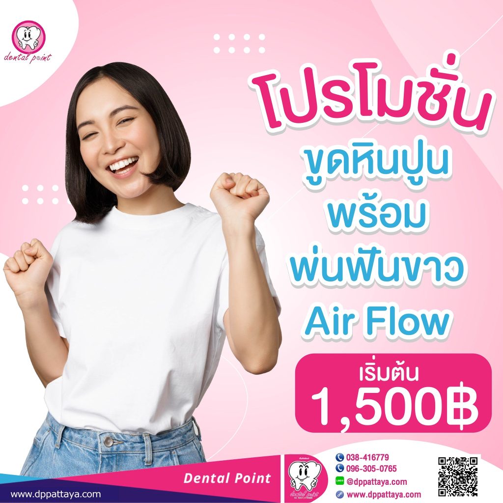 ขูดหินปูน พ่นฟันขาว Air flow ราคา