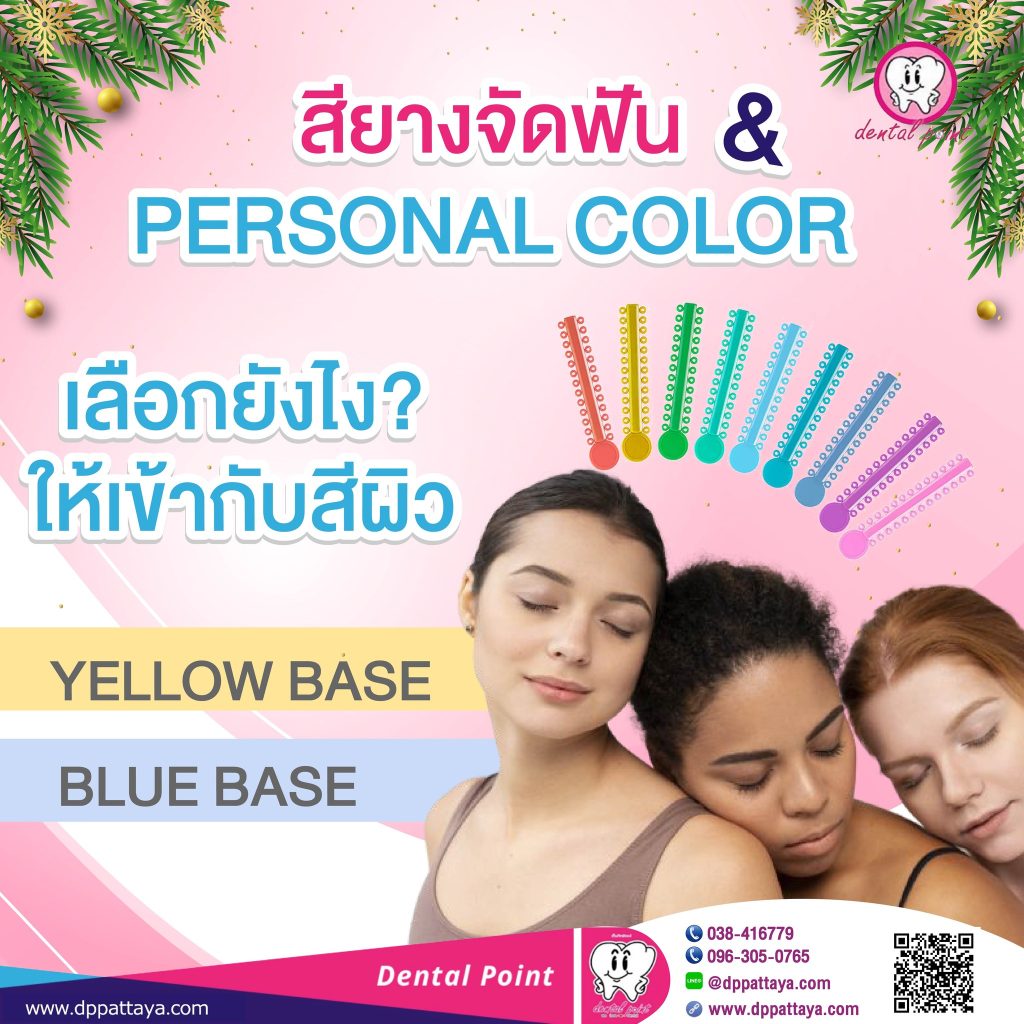 เทคนิคเลือกสียางจัดฟัน personal color