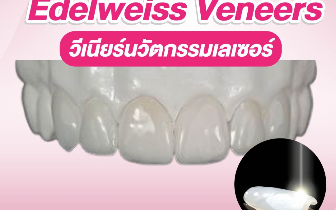 Edelweiss Veneers วีเนียร์สำเร็จรูปนวัตกรรมเลเซอร์