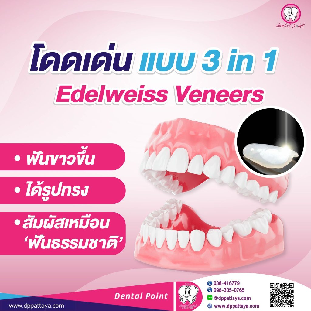 Edelweiss Veneers วีเนียร์สำเร็จรูปนวัตกรรมเลเซอร์